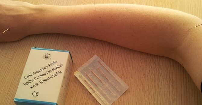 Eliminate Your Fears & Doubts About Acupuncture image